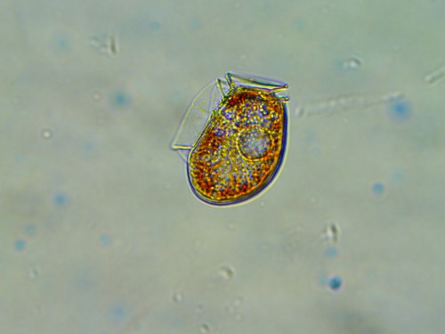 SEATT partners are monitoring for other kinds of toxic phytoplankton, such as Dinophysis. “It kind of looks like a pitcher filled with punch with Sangria,” said Kennedy. “We’re worried about that because it produced diuretic shellfish poisoning, which is very unpleasant but not high priority.” (Photo courtesy of Esther Kennedy)