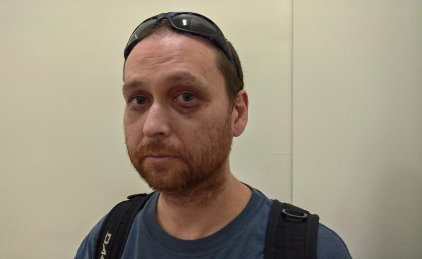Wesley Johnson says he was assaulted by seven people during a smoke break in the early morning hours of June 6, 2016. He was one of several people to plead with the Juneau Assembly on June 13, 2016, to recognize and do something about violence downtown. (Photo by Jeremy Hsieh/KTOO)