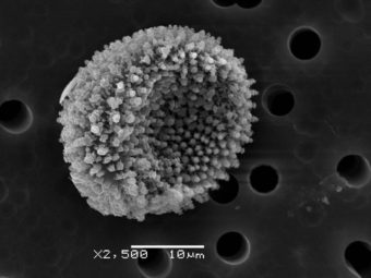 Picture from an electron scanning microscope of Kivalina spore