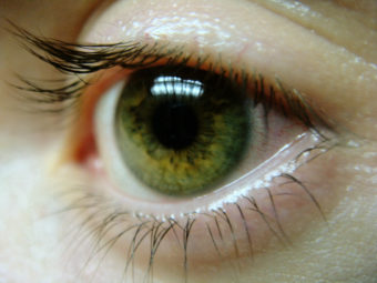 eyeball