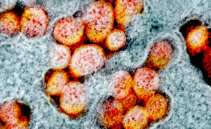This transmission electron microscope image shows particles of SARS-CoV-2, the coronavirus that causes the disease known as COVID-19. (Image courtesy of National Institute of Allergy and Infectious Diseases Integrated Research Facility)
