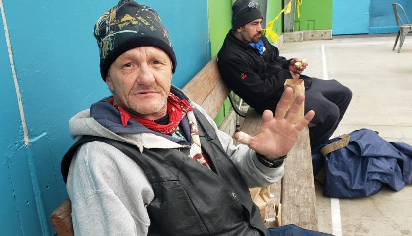Cary Shilts shows an injury got while working as a contractor in 2000 during the Glory Hall's lunch service at Zach Gordon Youth Center in Juneau on April 28, 2020.